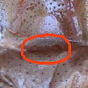 espermateca Acanthoscurria geniculata.jpg